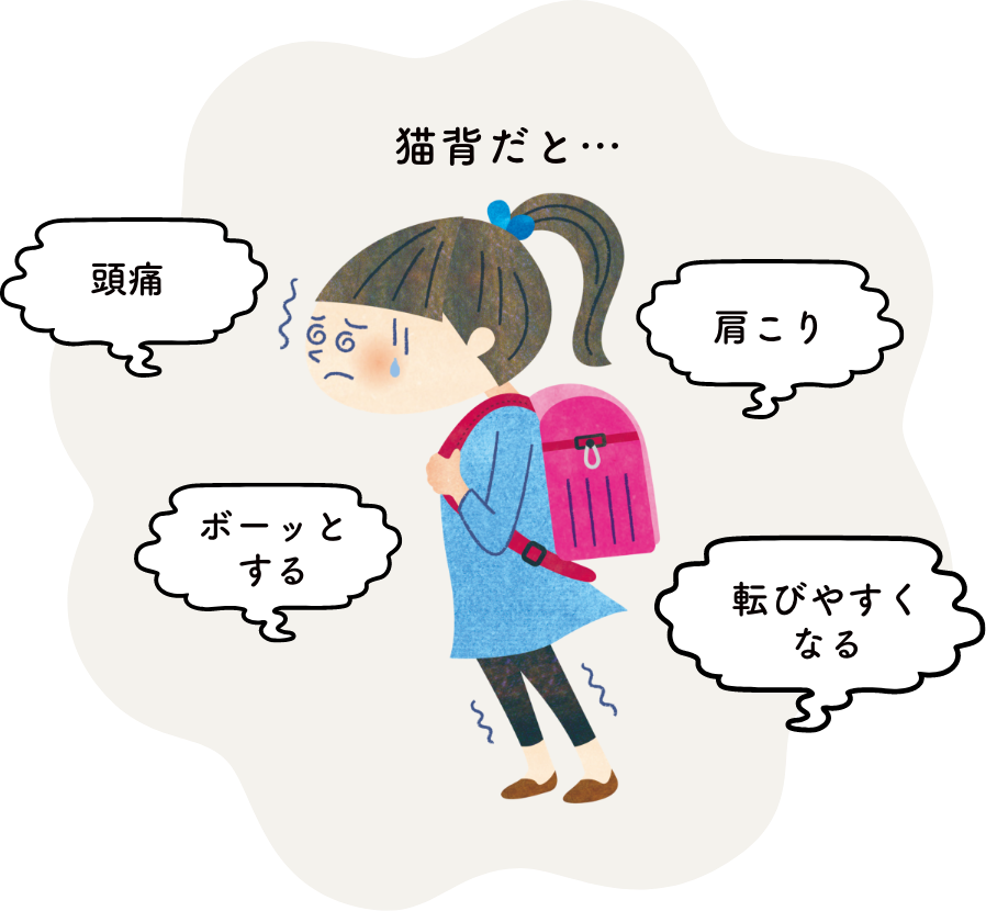 イメージ：重い荷物は猫背の原因に?