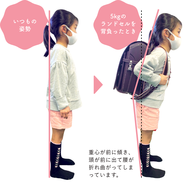 写真：いつもの姿勢と5kgのランドセルを背負ったとき